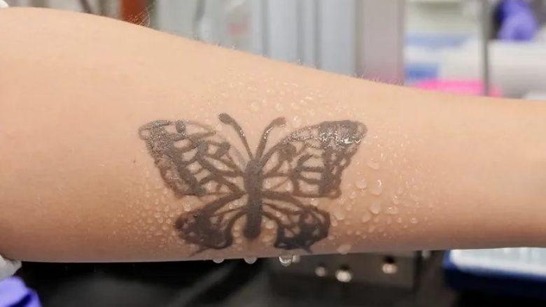 Koreja e Jugut zhvillon një ‘tatuazh elektronik’ që mund të paralajmërojë pacientët për probleme të mundshme shëndetësore