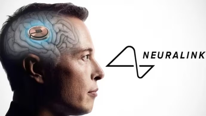 Neuralink implanton për herë të parë çipin e trurit tek njeriu