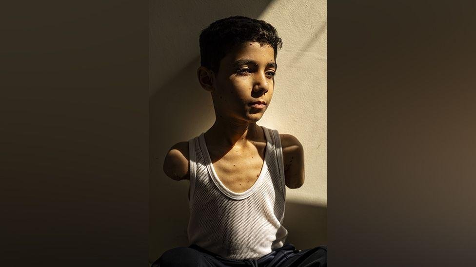 Portreti i një djali të plagosur nga Gaza shpallet fotografia e vitit nga World Press Photo 2025